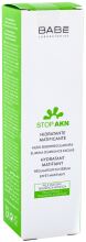 Emulsi&oacute;n Hidratante Matificante Stop Akn 50 ml